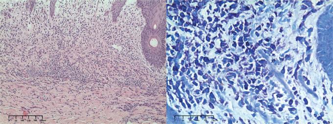 https://cdn.ncbi.nlm.nih.gov/pmc/blobs/2f31/12382381/b08645584040/ActaDV-105-43939-g002.jpg