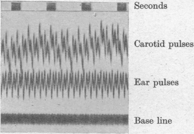 https://cdn.ncbi.nlm.nih.gov/pmc/blobs/2f32/1393494/731924915880/jphysiol01502-0100-a.jpg