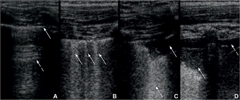 https://cdn.ncbi.nlm.nih.gov/pmc/blobs/2f36/11670560/25a65383eeef/gr2.jpg