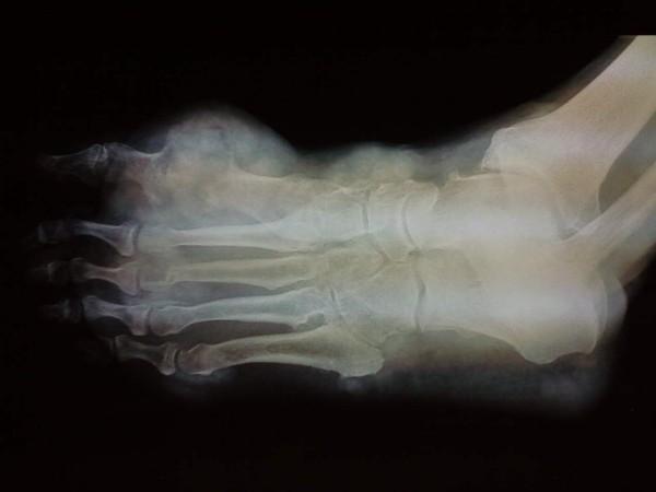 https://cdn.ncbi.nlm.nih.gov/pmc/blobs/2f36/3170636/4000d076dee0/1752-1947-5-397-6.jpg