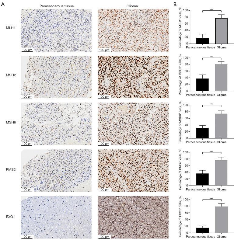 https://cdn.ncbi.nlm.nih.gov/pmc/blobs/2f39/12169988/2e08299d4153/tcr-14-05-2690-f7.jpg