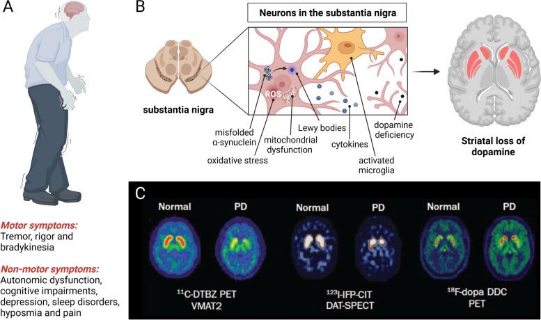 https://cdn.ncbi.nlm.nih.gov/pmc/blobs/2f3a/9912681/1c55624323fd/13024_2023_600_Fig1_HTML.jpg