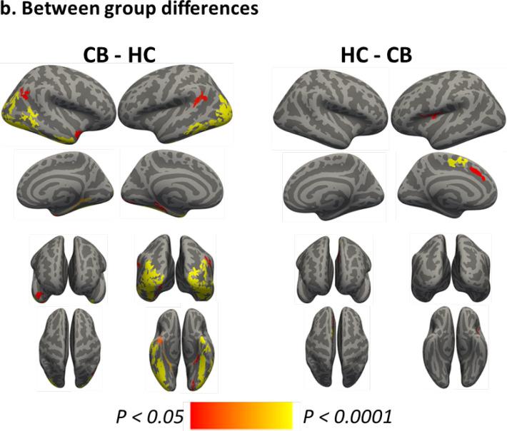 https://cdn.ncbi.nlm.nih.gov/pmc/blobs/2f3b/11016884/320e919c1fa1/BCN-14-647-g003b.jpg