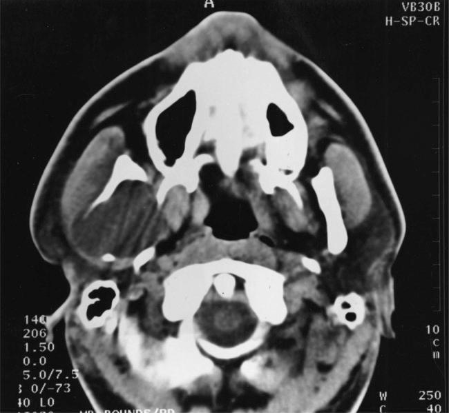 https://cdn.ncbi.nlm.nih.gov/pmc/blobs/2f3b/4159604/8508de4b4c16/rju09101.jpg