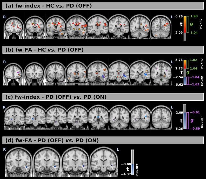 https://cdn.ncbi.nlm.nih.gov/pmc/blobs/2f3c/12283281/049b4f2d96ad/fneur-16-1605753-g001.jpg