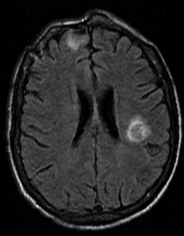 https://cdn.ncbi.nlm.nih.gov/pmc/blobs/2f3f/3892585/683624a2e5d4/idr-2010-2-e10-g003.jpg