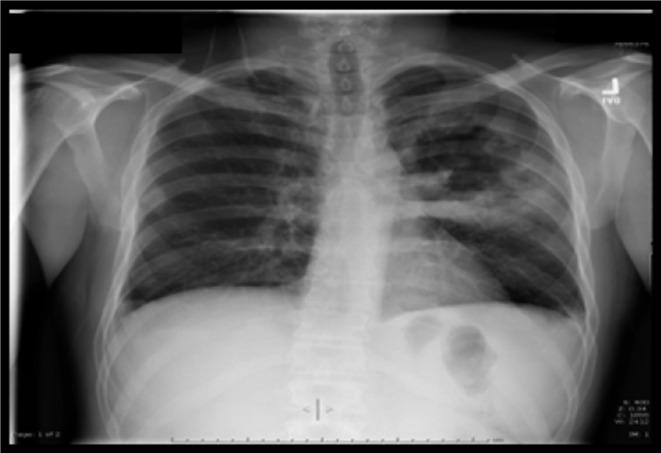 https://cdn.ncbi.nlm.nih.gov/pmc/blobs/2f3f/3892585/6f4535171498/idr-2010-2-e10-g001.jpg