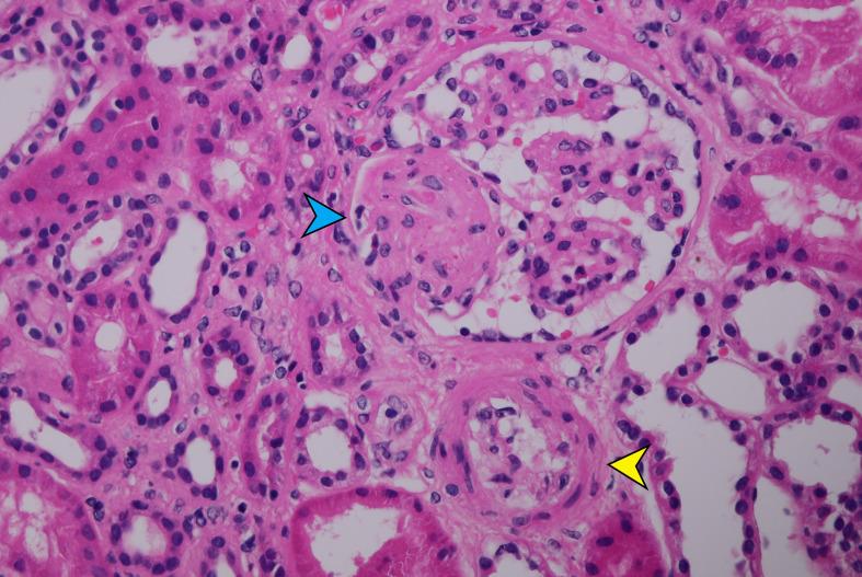 https://cdn.ncbi.nlm.nih.gov/pmc/blobs/2f43/9580272/66a7b83f093a/fimmu-13-1001366-g001.jpg