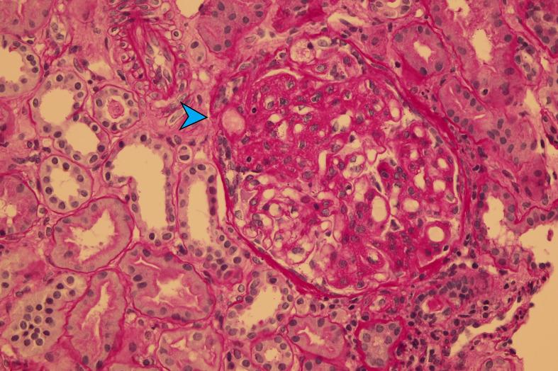 https://cdn.ncbi.nlm.nih.gov/pmc/blobs/2f43/9580272/91aab2fd3ffe/fimmu-13-1001366-g003.jpg