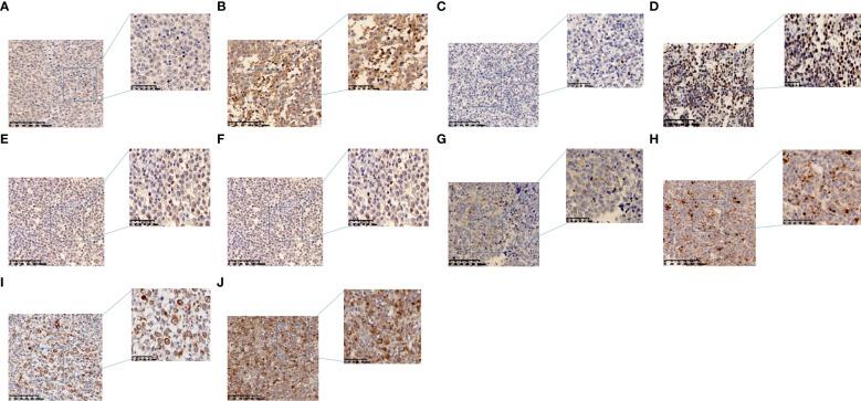 https://cdn.ncbi.nlm.nih.gov/pmc/blobs/2f44/9763555/55c663b51f16/fonc-12-1069378-g001.jpg