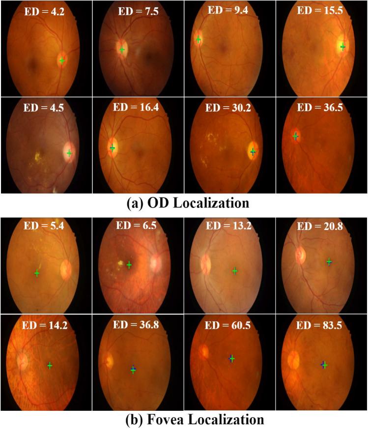 https://cdn.ncbi.nlm.nih.gov/pmc/blobs/2f46/11452642/6b09501d92d6/41598_2024_73493_Fig9_HTML.jpg