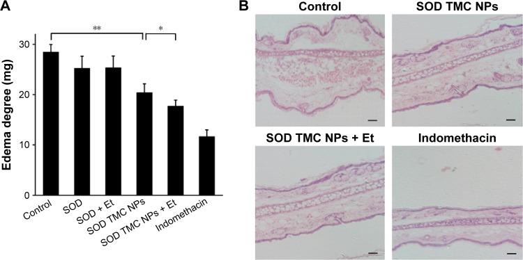 https://cdn.ncbi.nlm.nih.gov/pmc/blobs/2f47/5087780/379911b560b1/ijn-11-5549Fig11.jpg