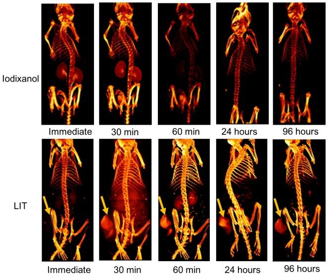 https://cdn.ncbi.nlm.nih.gov/pmc/blobs/2f47/6401496/76299467b342/thnov09p1323g006.jpg
