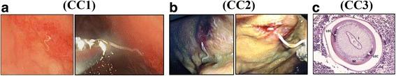 https://cdn.ncbi.nlm.nih.gov/pmc/blobs/2f4d/5539894/54c62e86f5a5/12879_2017_2633_Fig1_HTML.jpg
