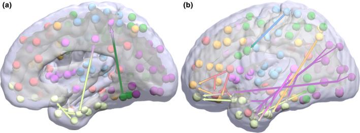 https://cdn.ncbi.nlm.nih.gov/pmc/blobs/2f4e/11579218/29ff3e7c3ac8/PSYP-61-e14674-g001.jpg