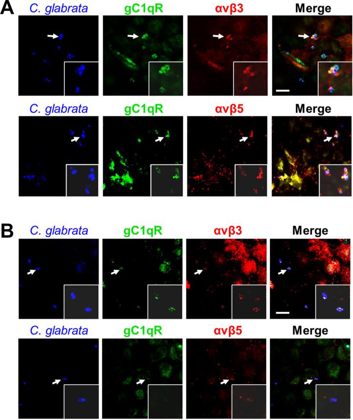 https://cdn.ncbi.nlm.nih.gov/pmc/blobs/2f4f/9295963/84785e146c5e/ppat.1010681.g004.jpg