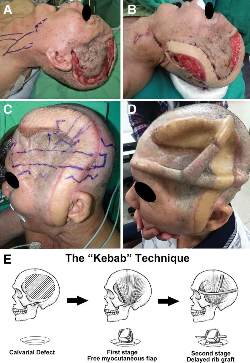 https://cdn.ncbi.nlm.nih.gov/pmc/blobs/2f51/10476743/879016c7c8e7/medi-102-e34963-g002.jpg