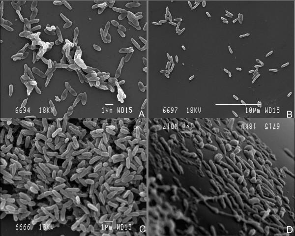 https://cdn.ncbi.nlm.nih.gov/pmc/blobs/2f51/2841157/0543636372a7/1471-2180-10-38-1.jpg