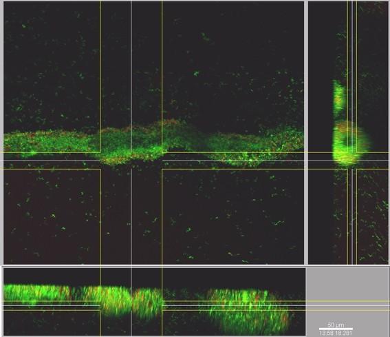 https://cdn.ncbi.nlm.nih.gov/pmc/blobs/2f51/2841157/abb8ae92cfd7/1471-2180-10-38-5.jpg