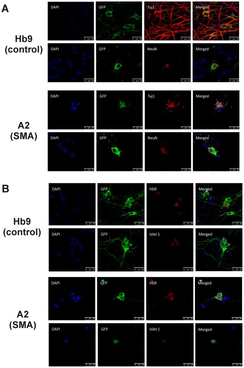 https://cdn.ncbi.nlm.nih.gov/pmc/blobs/2f52/4156416/a743dcfd276b/pone.0106818.g004.jpg