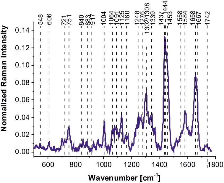 https://cdn.ncbi.nlm.nih.gov/pmc/blobs/2f55/5689610/1658bb5534ea/oncotarget-08-85290-g004.jpg