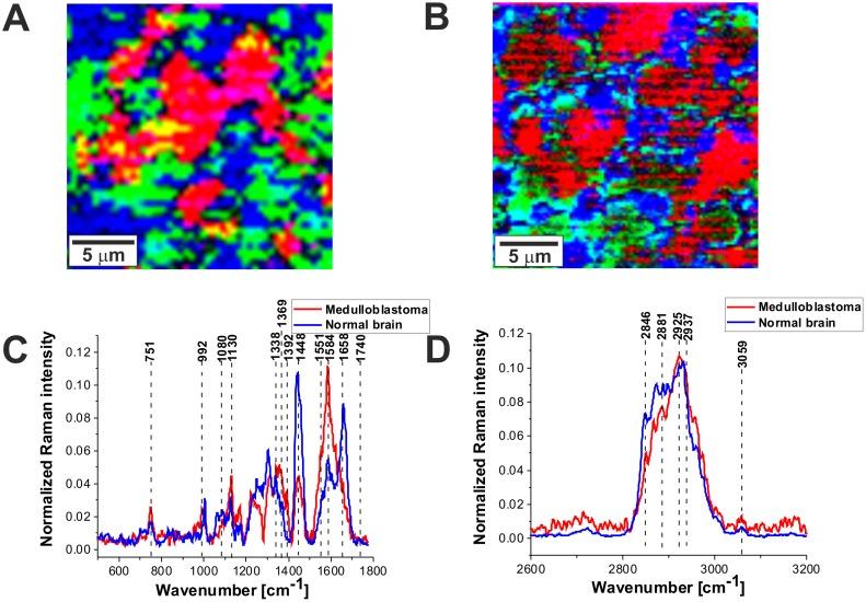 https://cdn.ncbi.nlm.nih.gov/pmc/blobs/2f55/5689610/2b5a39e0015c/oncotarget-08-85290-g006.jpg
