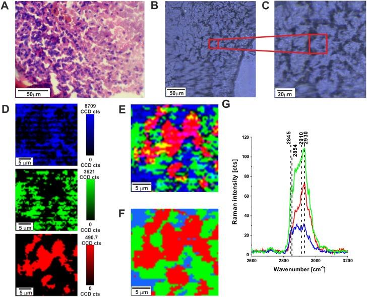 https://cdn.ncbi.nlm.nih.gov/pmc/blobs/2f55/5689610/2d62e0370024/oncotarget-08-85290-g001.jpg