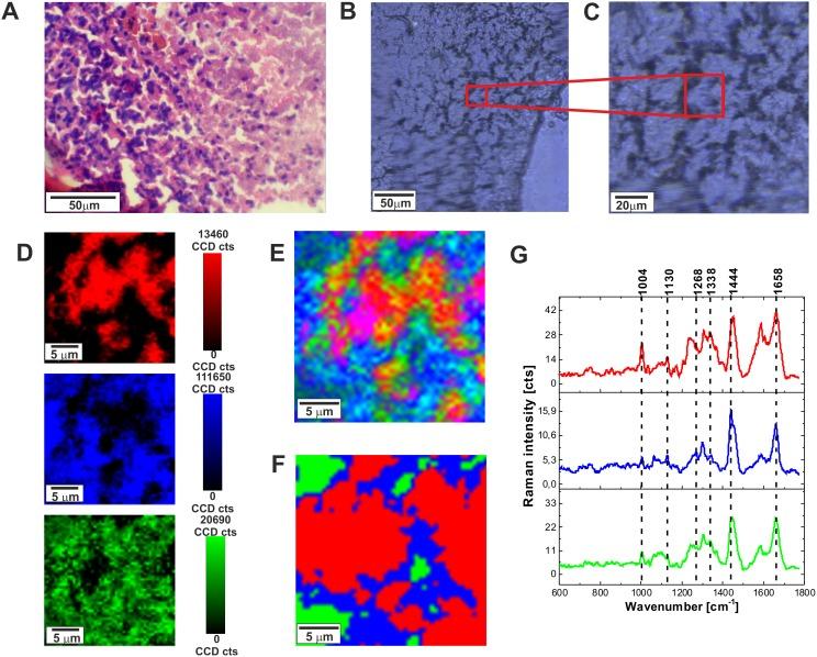 https://cdn.ncbi.nlm.nih.gov/pmc/blobs/2f55/5689610/6a4311c30990/oncotarget-08-85290-g002.jpg