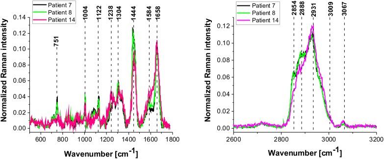 https://cdn.ncbi.nlm.nih.gov/pmc/blobs/2f55/5689610/7482ec2b7576/oncotarget-08-85290-g010.jpg