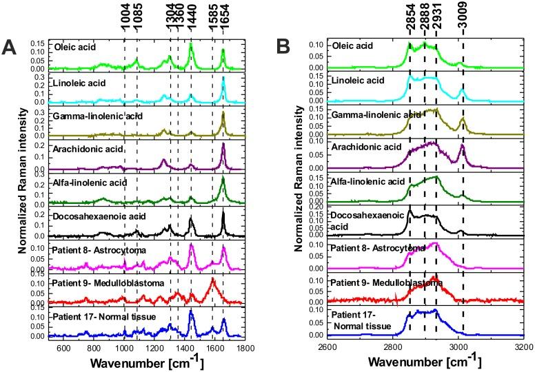 https://cdn.ncbi.nlm.nih.gov/pmc/blobs/2f55/5689610/77e6d8b6d099/oncotarget-08-85290-g007.jpg