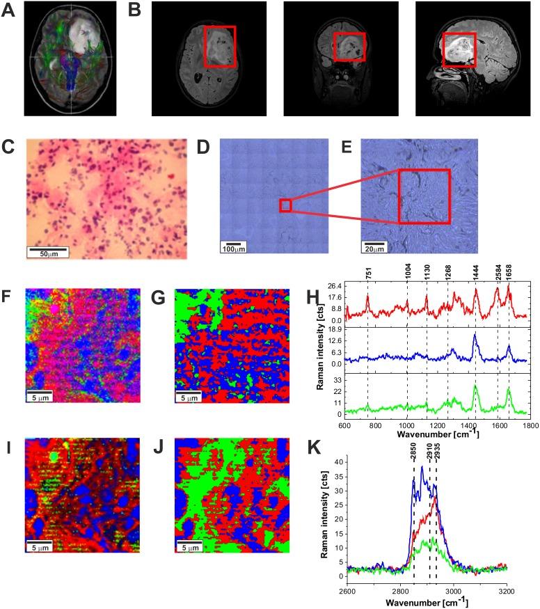 https://cdn.ncbi.nlm.nih.gov/pmc/blobs/2f55/5689610/78614ff50bee/oncotarget-08-85290-g009.jpg