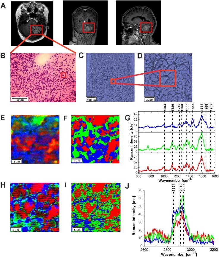 https://cdn.ncbi.nlm.nih.gov/pmc/blobs/2f55/5689610/e4d706aa996f/oncotarget-08-85290-g005.jpg