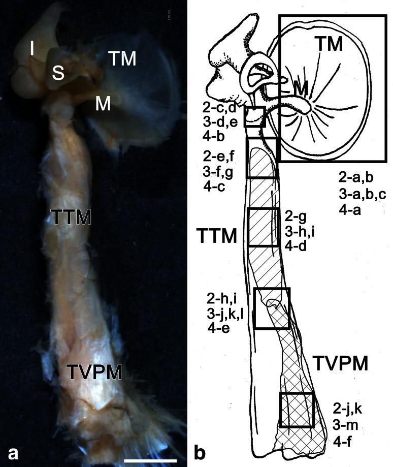 https://cdn.ncbi.nlm.nih.gov/pmc/blobs/2f58/3978212/74ed6dd0fc89/405_2013_2469_Fig1_HTML.jpg