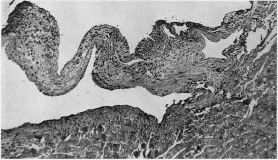 https://cdn.ncbi.nlm.nih.gov/pmc/blobs/2f59/1010385/b3b9b1c4a641/annrheumd00217-0004-a.jpg