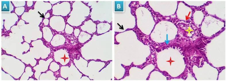 https://cdn.ncbi.nlm.nih.gov/pmc/blobs/2f5a/8317526/3e3bdc00257a/jcav12p5249g003.jpg