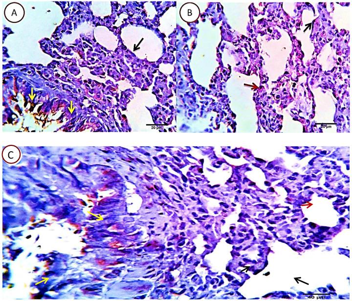 https://cdn.ncbi.nlm.nih.gov/pmc/blobs/2f5a/8317526/b8bd326046e9/jcav12p5249g008.jpg