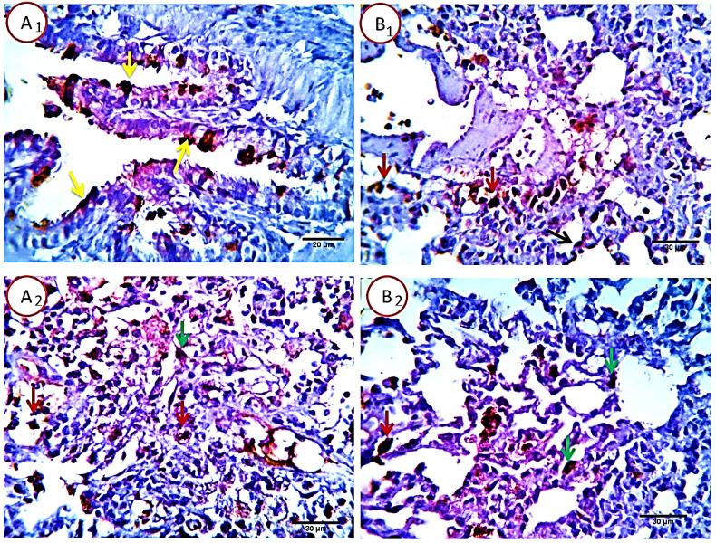 https://cdn.ncbi.nlm.nih.gov/pmc/blobs/2f5a/8317526/b9421aca85c7/jcav12p5249g007.jpg