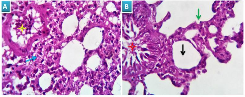 https://cdn.ncbi.nlm.nih.gov/pmc/blobs/2f5a/8317526/dffc3b076b5d/jcav12p5249g005.jpg
