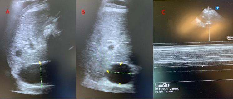 https://cdn.ncbi.nlm.nih.gov/pmc/blobs/2f5f/9994305/19059ffc51a6/pocusj-07-15016-g004.jpg