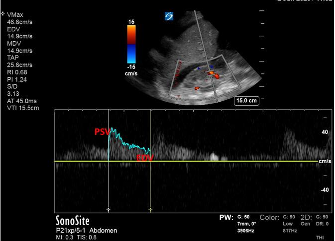 https://cdn.ncbi.nlm.nih.gov/pmc/blobs/2f5f/9994305/60d9e458f4d4/pocusj-07-15016-g002.jpg