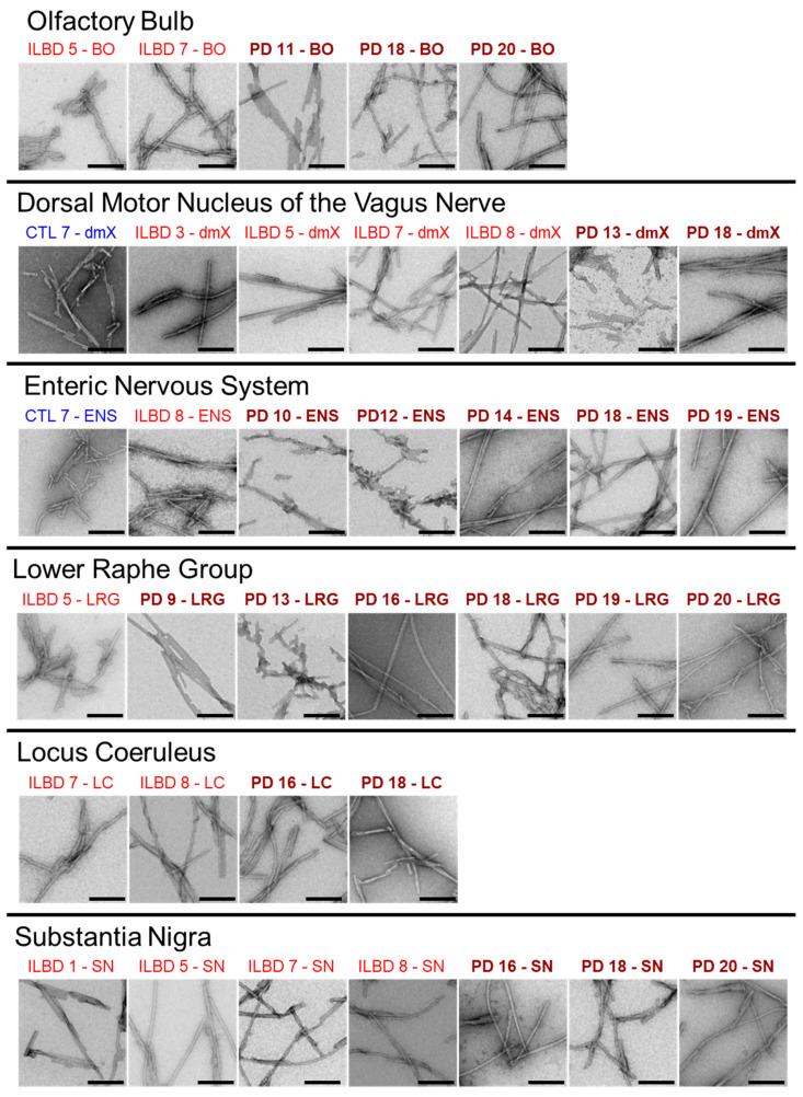 https://cdn.ncbi.nlm.nih.gov/pmc/blobs/2f60/7828121/45cb29a352aa/cells-10-00139-g004.jpg