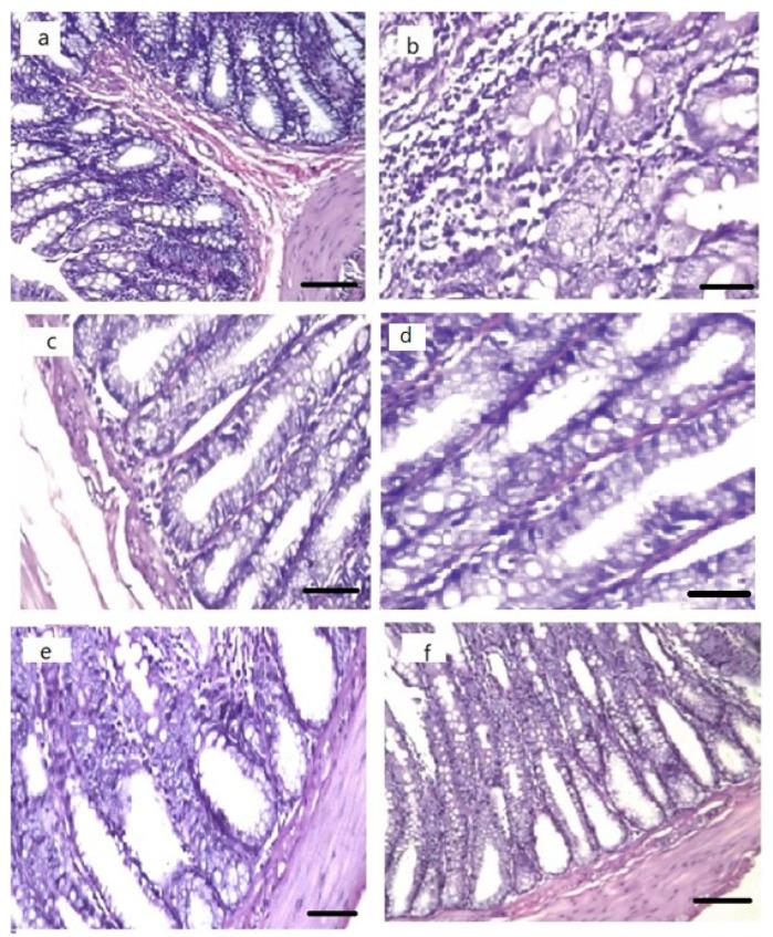 https://cdn.ncbi.nlm.nih.gov/pmc/blobs/2f61/9960579/bc6013988bc1/pharmaceutics-15-00680-g014.jpg