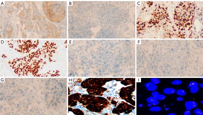 https://cdn.ncbi.nlm.nih.gov/pmc/blobs/2f66/7815378/05fc8dcd4598/tlcr-09-06-2494-f2.jpg