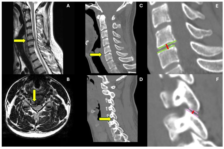 https://cdn.ncbi.nlm.nih.gov/pmc/blobs/2f69/11122480/f5f37d0a2b91/jcm-13-02976-g001.jpg