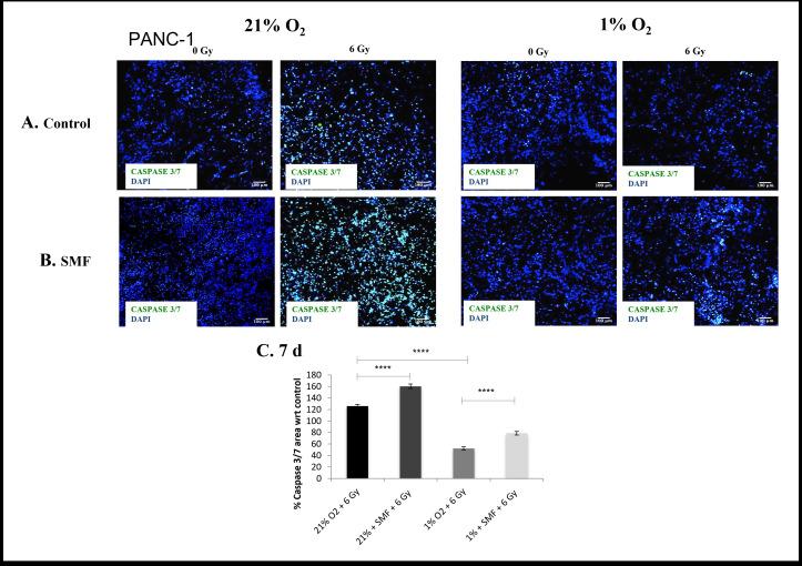 https://cdn.ncbi.nlm.nih.gov/pmc/blobs/2f69/9975369/ddca515d6d5a/bjr.20220832.g004.jpg