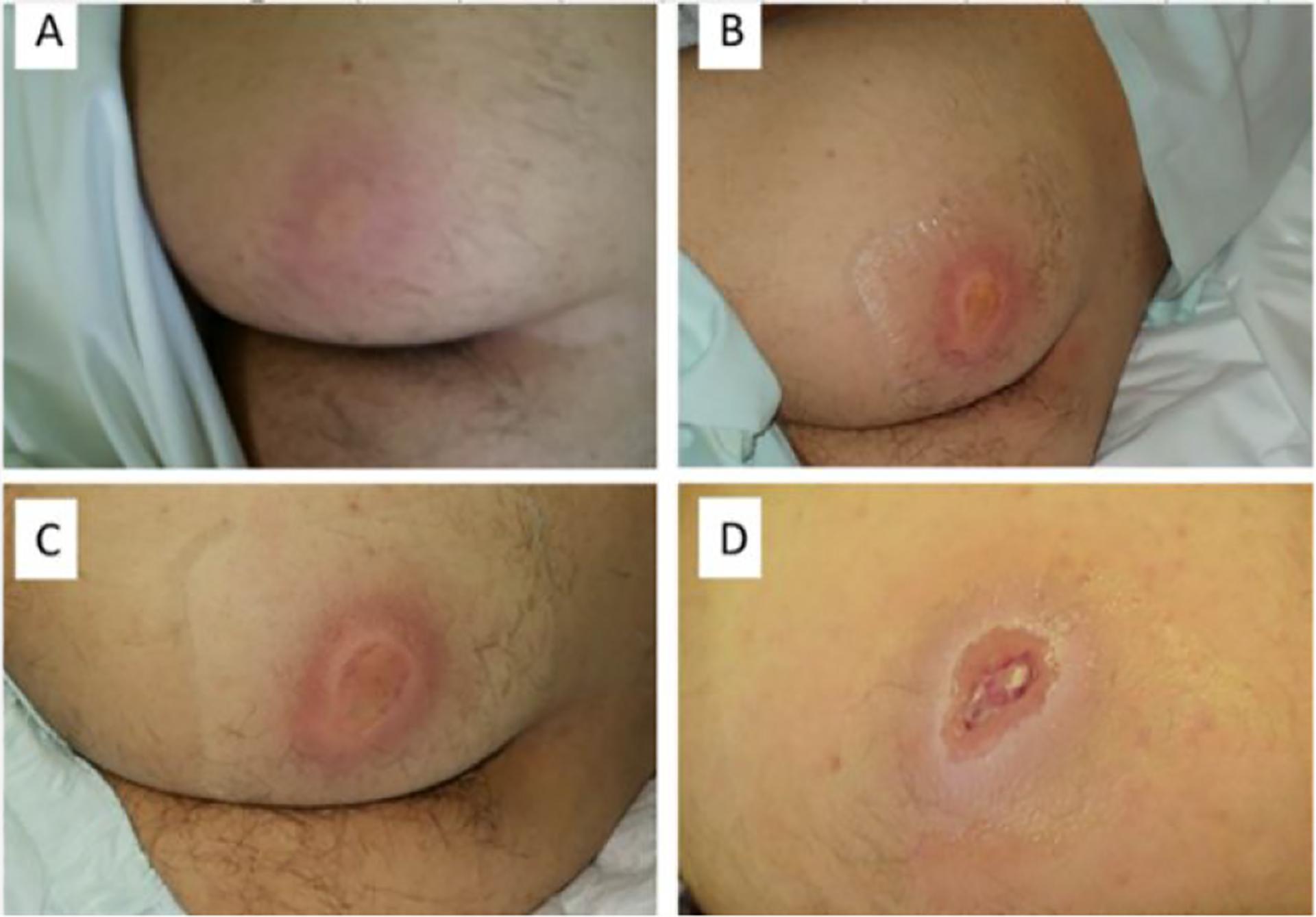 https://cdn.ncbi.nlm.nih.gov/pmc/blobs/2f6b/8785213/372358461ed9/nihms-1770052-f0011.jpg