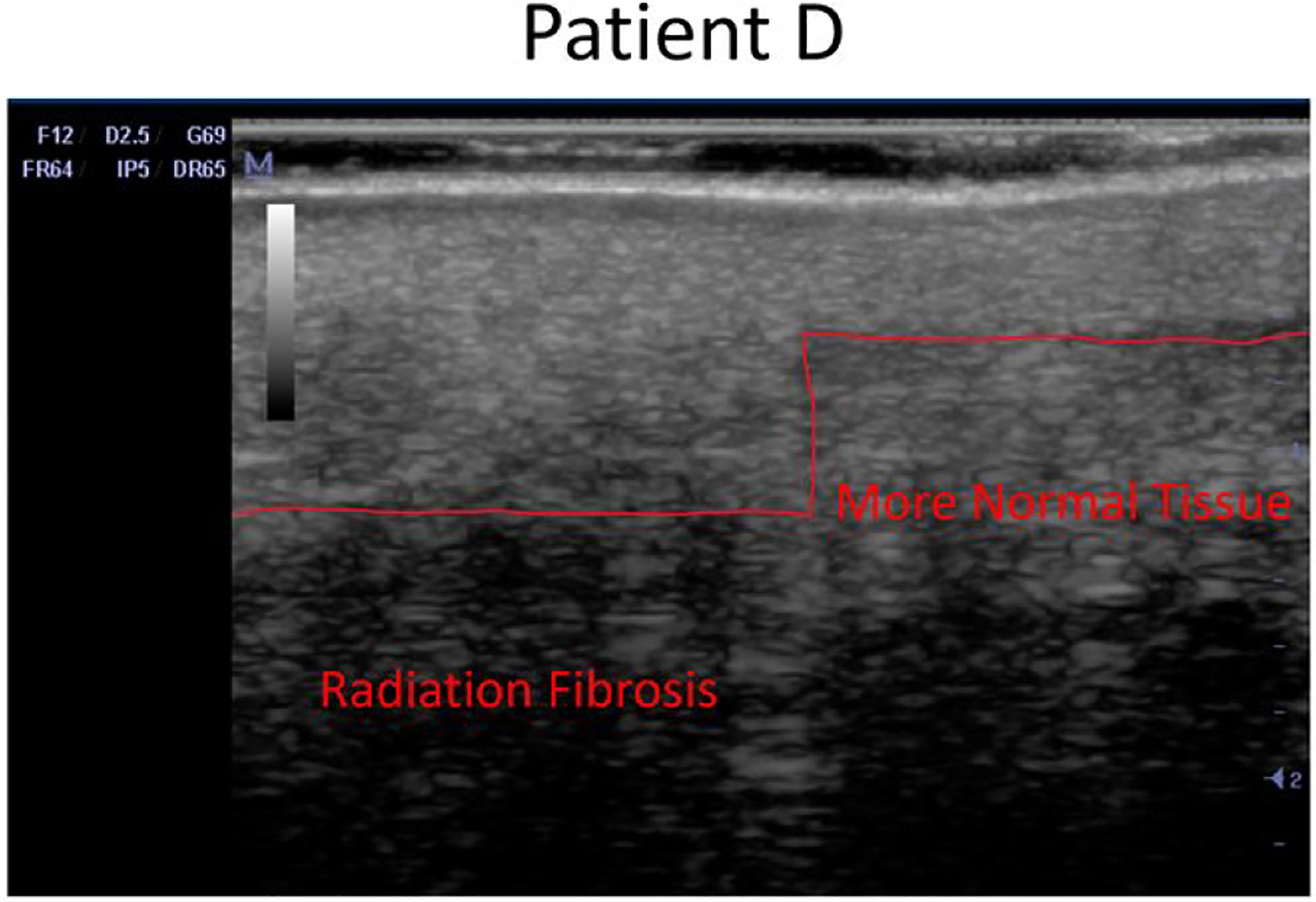 https://cdn.ncbi.nlm.nih.gov/pmc/blobs/2f6b/8785213/edf32ab542a2/nihms-1770052-f0009.jpg