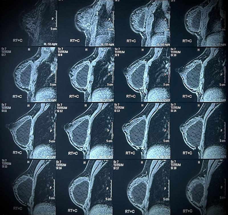 https://cdn.ncbi.nlm.nih.gov/pmc/blobs/2f6f/11649290/aad2a062bc5b/gox-12-e6386-g004.jpg