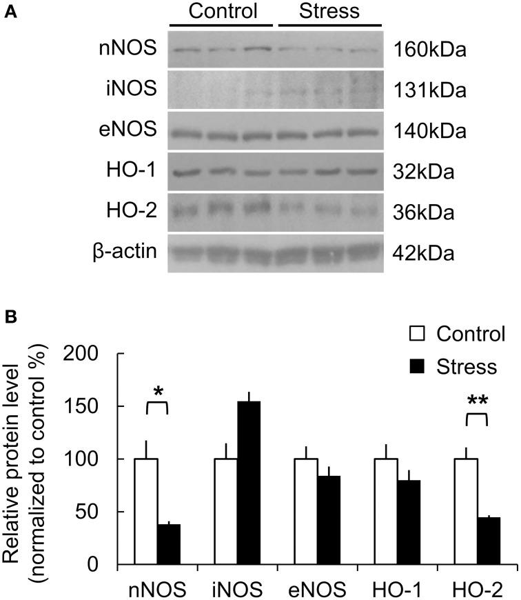https://cdn.ncbi.nlm.nih.gov/pmc/blobs/2f71/4688360/a425af7cecbd/fnins-09-00462-g0004.jpg