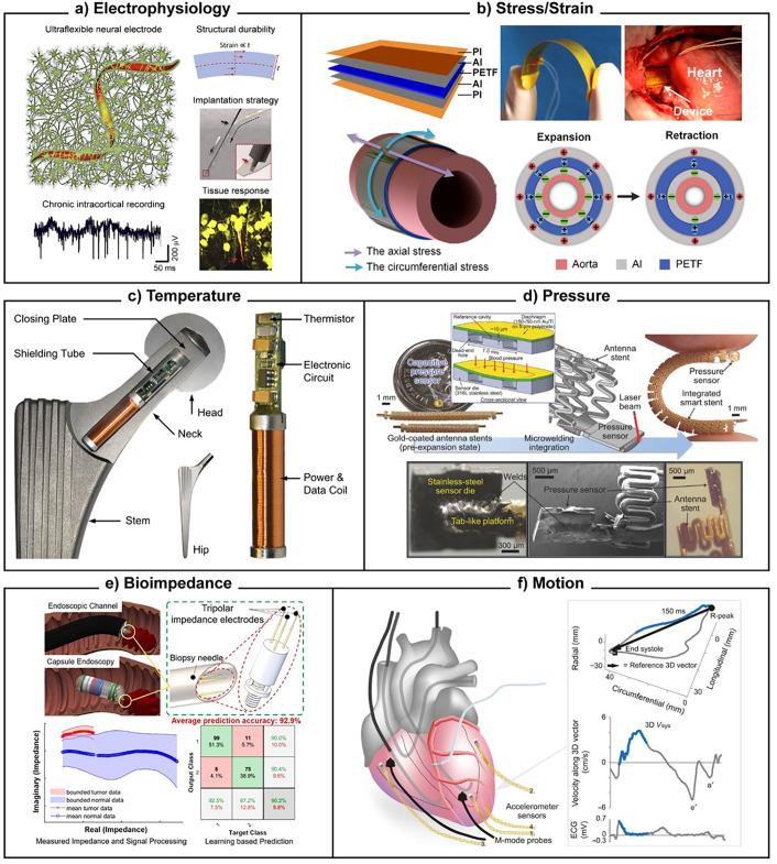 https://cdn.ncbi.nlm.nih.gov/pmc/blobs/2f72/10539032/746944d04f0c/ABPID9-000007-031506_1-g003.jpg